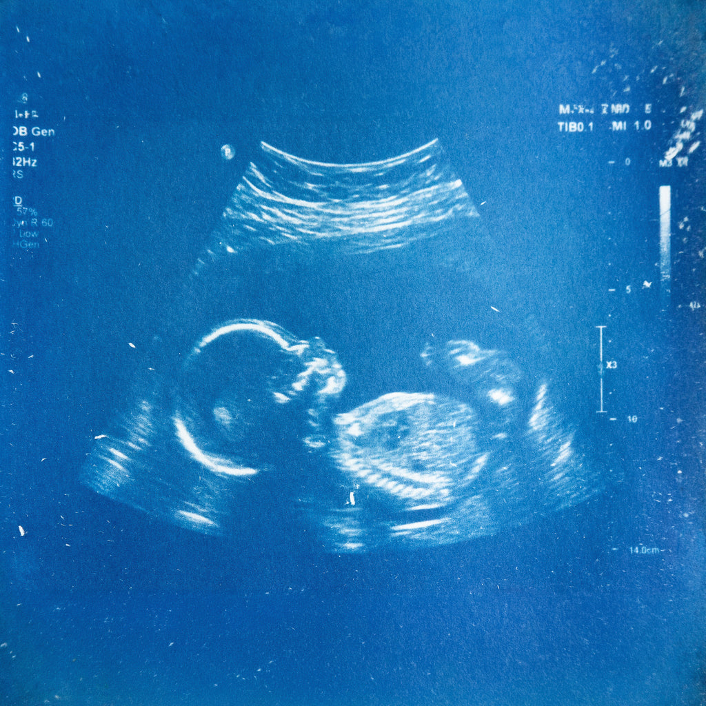 Annonces en cyanotype - à partir de votre photographie